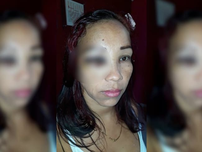 Mujer denuncia agresión por parte de Policías en Malambo, Atlántico. Foto: Cindy Anguila