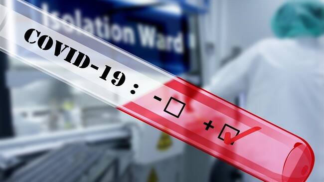 Norte de Santander tendrá laboratorio para realizar las pruebas del covid-19. Foto: Pixabay