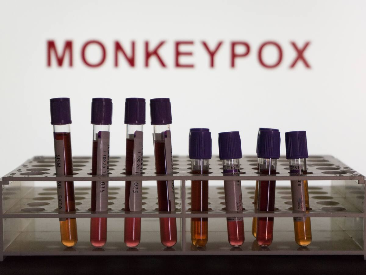 No hay que caer en el pánico, la expansión de mpox requiere una respuesta unificada: ONU