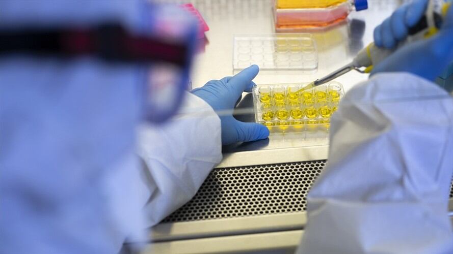 El objetivo es atajar la "tormenta citoquínica", una reacción inflamatoria descontrolada que surge en las formas más graves de neumonía causada por COVID-19.. Foto: Getty Images