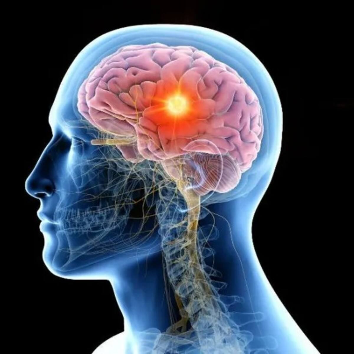 ¿Qué es muerte cerebral? Causas, señales de alerta y explicación, según neurólogo