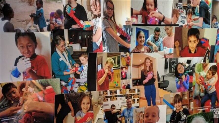 Familias de todo el mundo mandan fotos de sus hijos con los brazos fabricados en el jardín de una casa de Gales. Foto: BBC Mundo.
