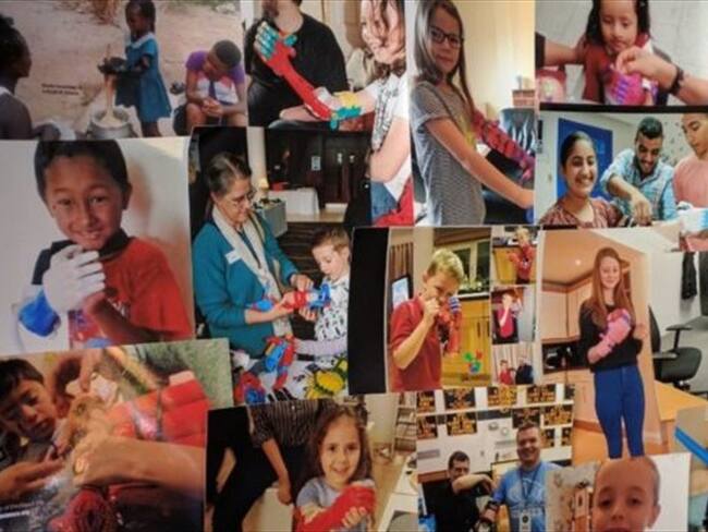 Familias de todo el mundo mandan fotos de sus hijos con los brazos fabricados en el jardín de una casa de Gales. Foto: BBC Mundo.