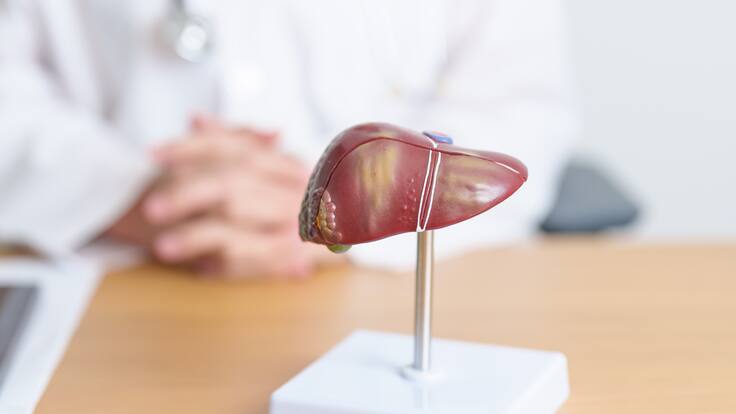 Cáncer de hígado: principales causas y cómo prevenirlo