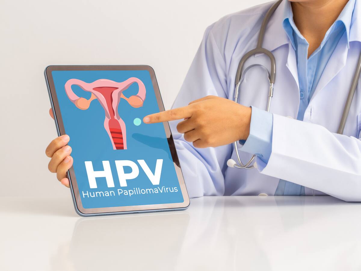 ¿El virus de papiloma humano es igual que el cáncer de cuello uterino? Médico aclaró dudas