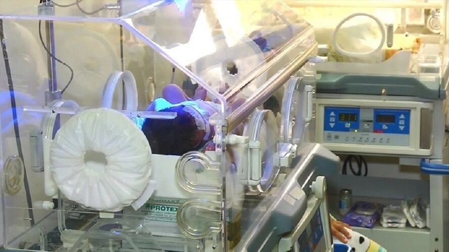 Muere bebé de 4 meses por desnutrición y maltrato físico en el Magdalena. Imagen de referencia. Foto: Colprensa