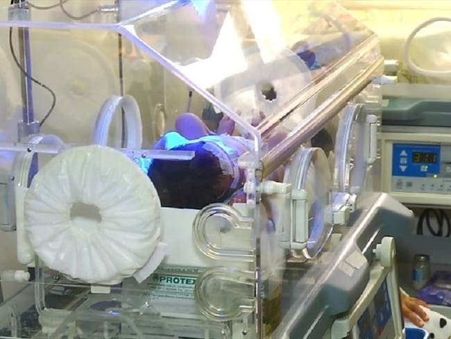 Muere bebé de 4 meses por desnutrición y maltrato físico en el Magdalena. Imagen de referencia. Foto: Colprensa