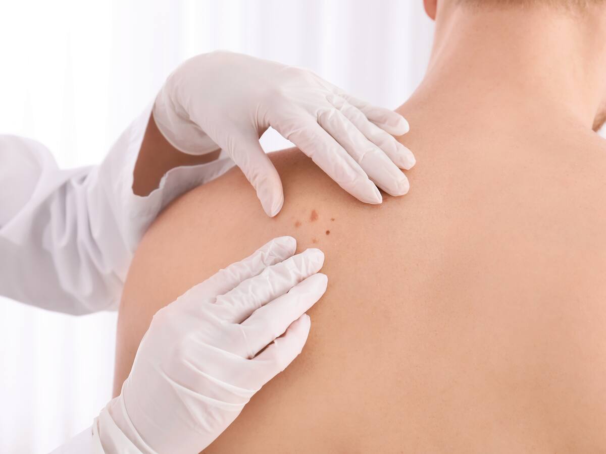 ¿Cuáles son sus factores de riesgo y cómo evitarlo?