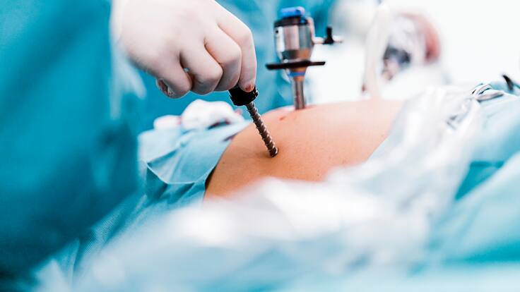 ¿Es normal que la cirugía bariátrica genere vómito? Experto responde y entrega consejos