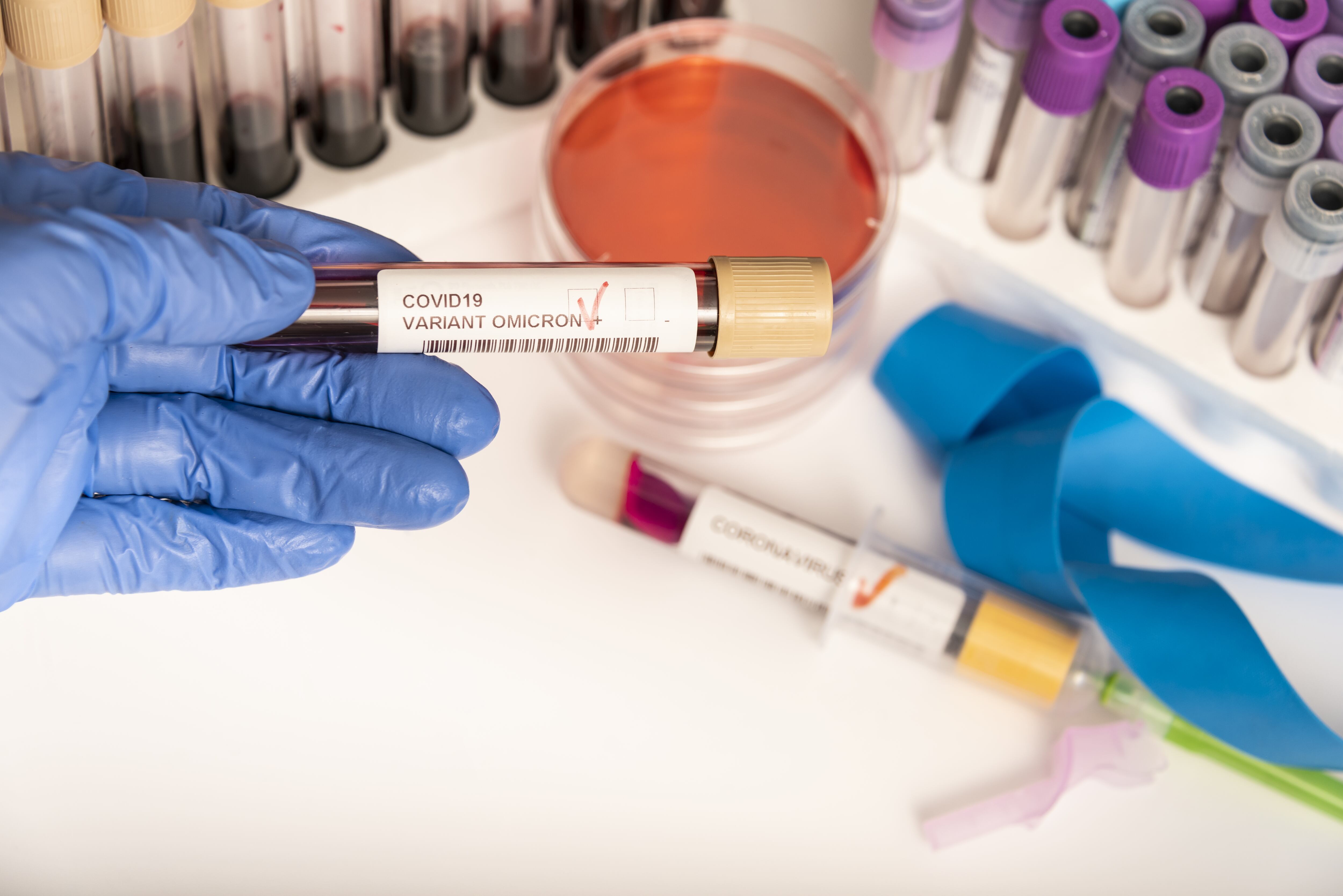 Coronavirus 2019-nCoV variant OMICRON Blood Sample. New Epidemic Corona Virus. South African variant