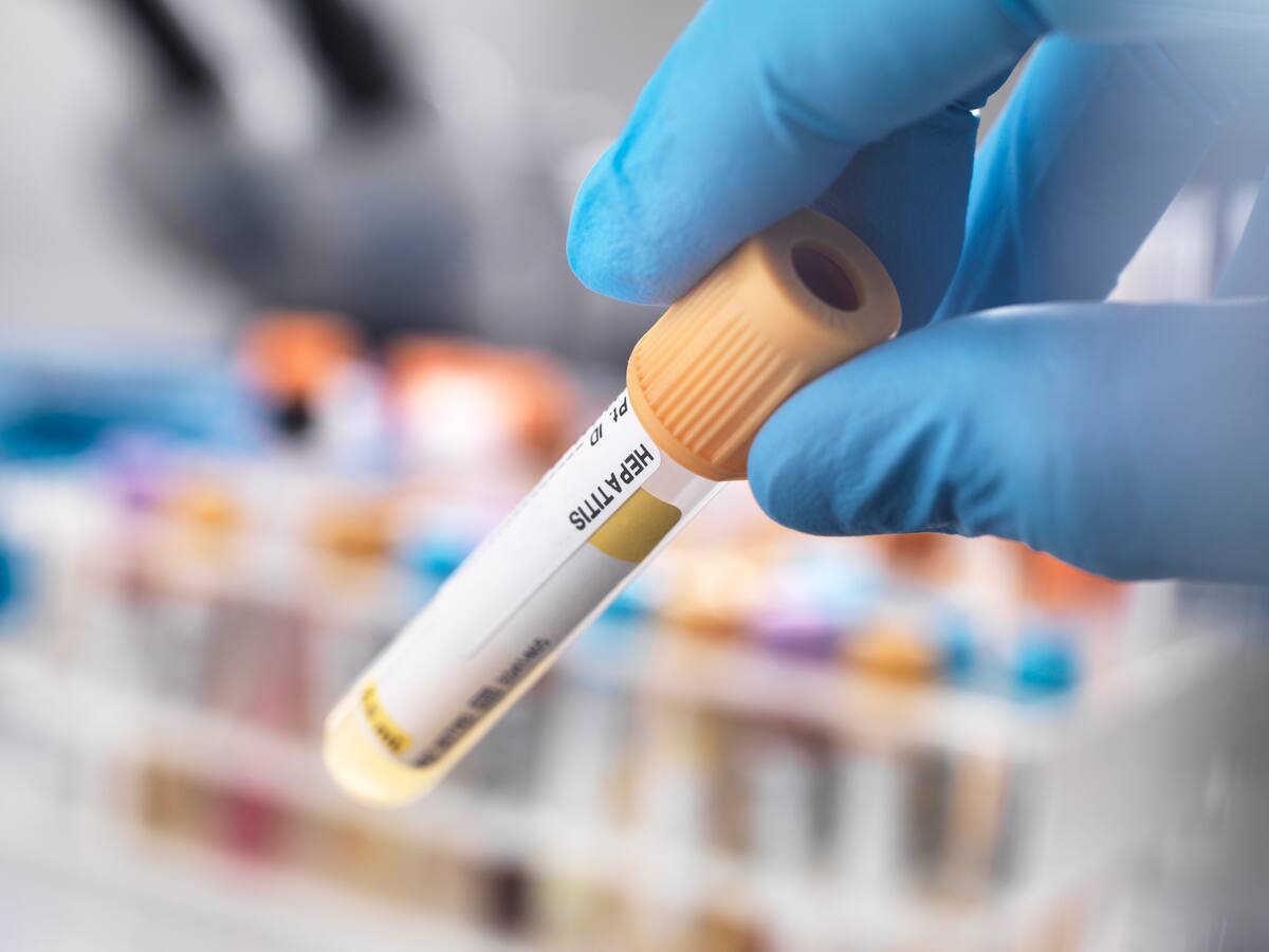 Hepatitis aguda en niños no está asociada a vacunación contra COVID-19: INS