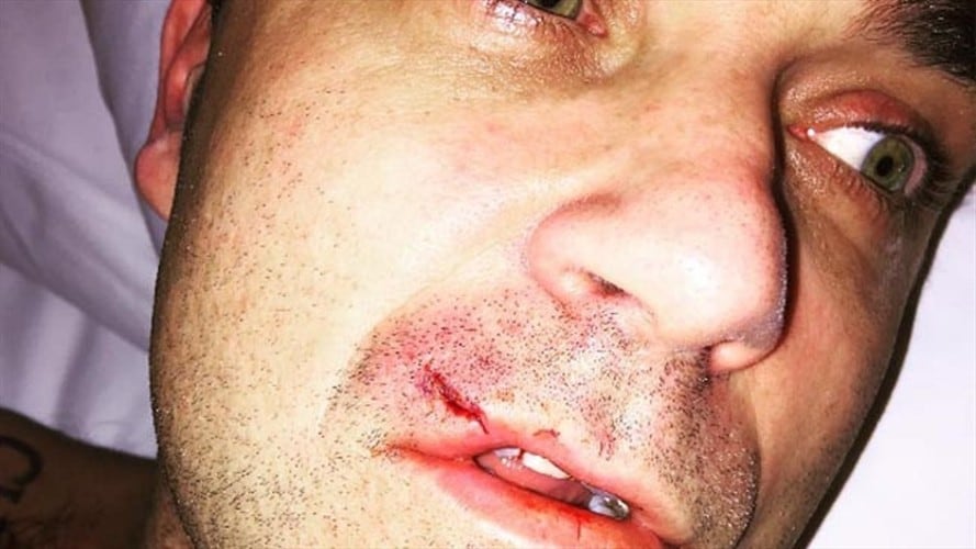 Robbie Williams acaba con el labio sangrando tras una 'pelea' con su ordenador. Foto: Bang Media