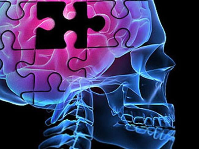 Alzhéimer..... Foto: Colprensa