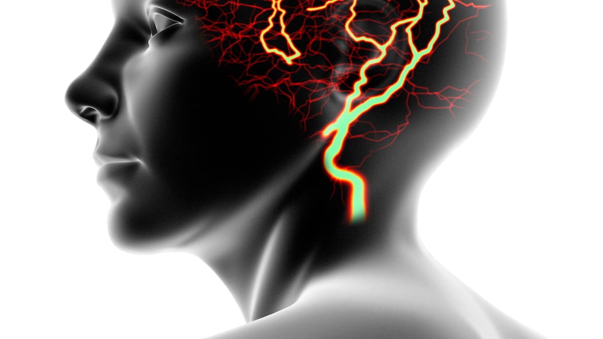 ¿Qué hacer en caso de una crisis epiléptica? Experta explicó