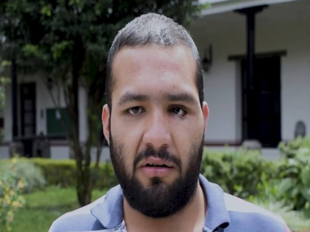 Estudiante que perdió uno de sus ojos apoya la protesta en Cauca
