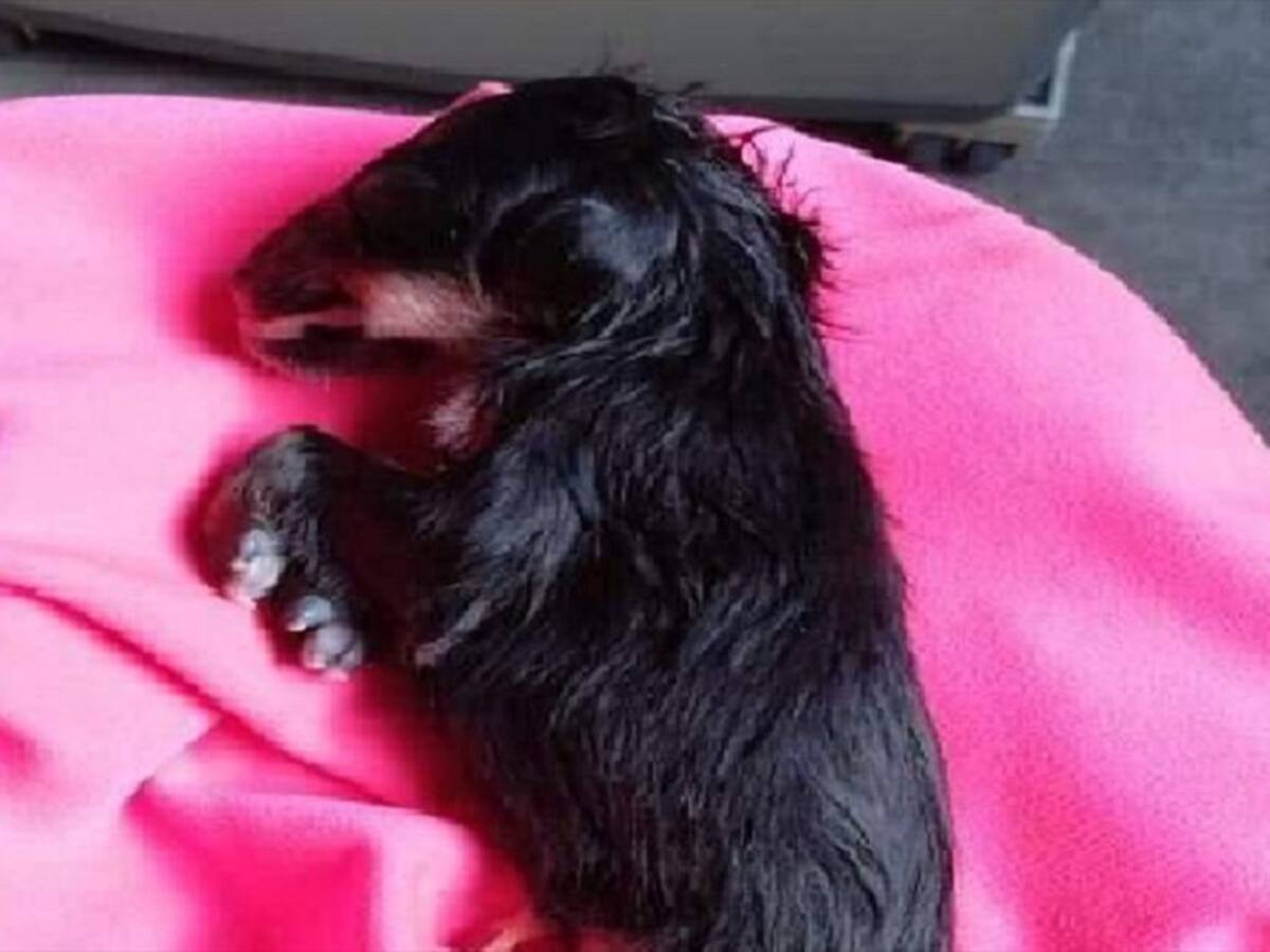 Nuevo caso de posible anencefalia en Barrancabermeja