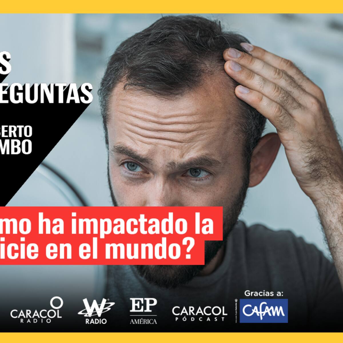 Mis Preguntas, con Roberto Pombo: ¿Qué tanto ha impactado la calvicie en el mundo?