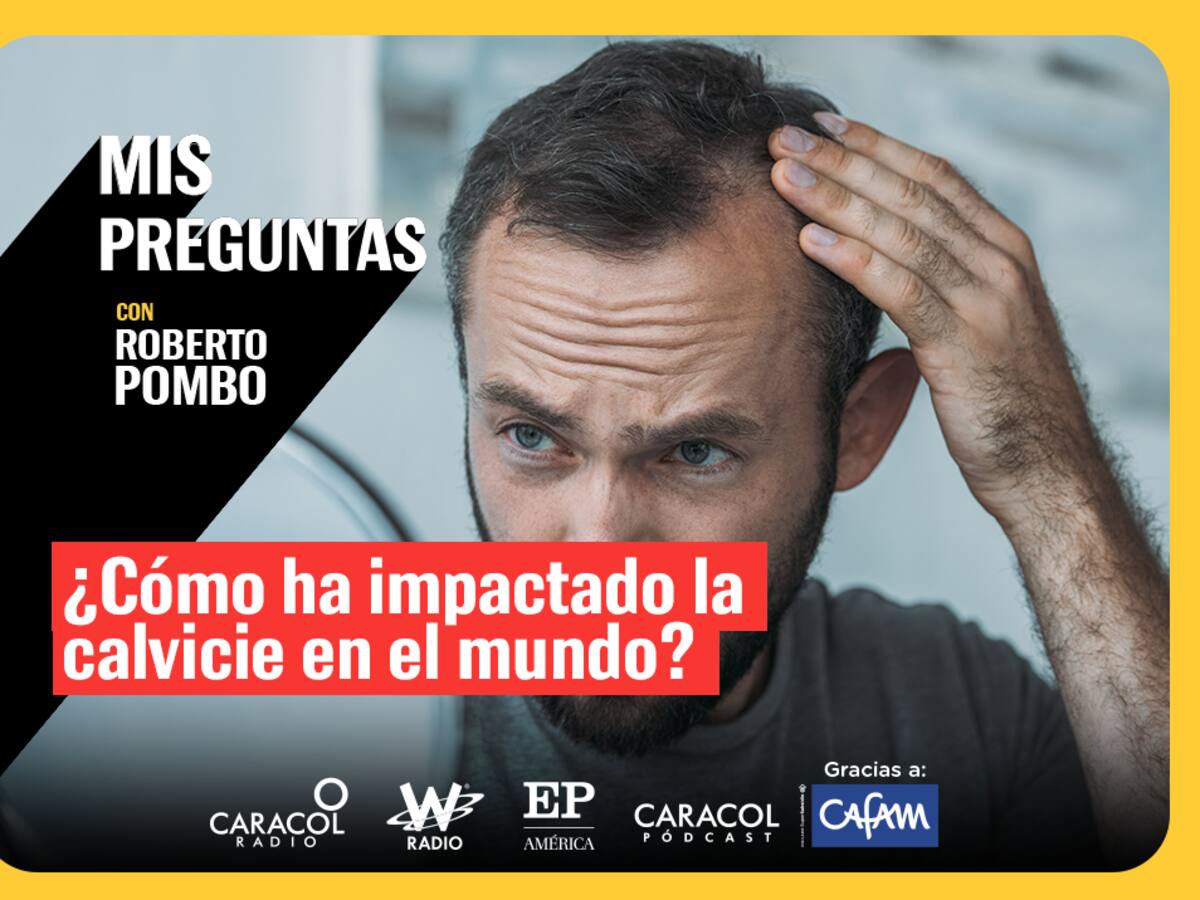 Mis Preguntas, con Roberto Pombo: ¿Qué tanto ha impactado la calvicie en el mundo?