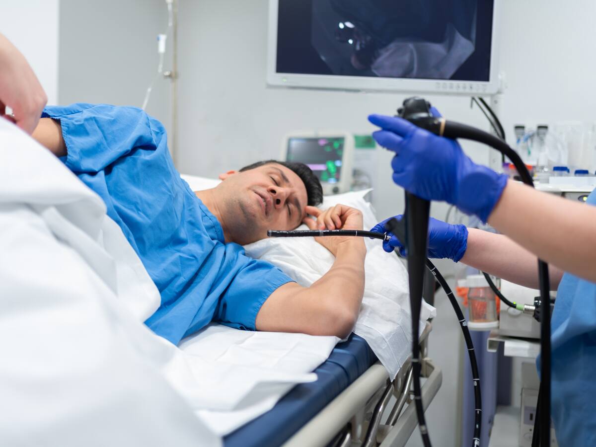 ¿Cuándo es necesario que se realice una colonoscopia? Experto dio detalles