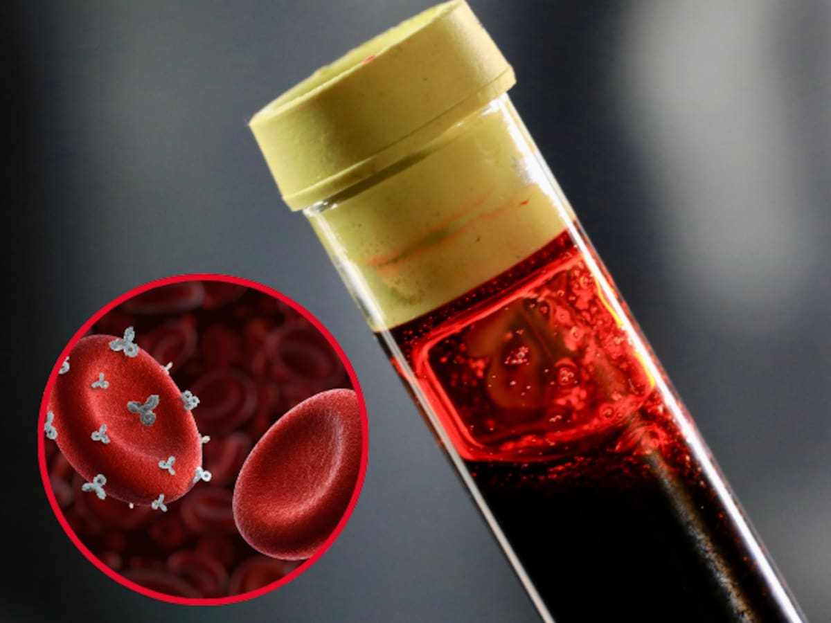 Rh nulo el tipo de sangre más raro del mundo: ¿Cuál es la mutación que lo provoca?