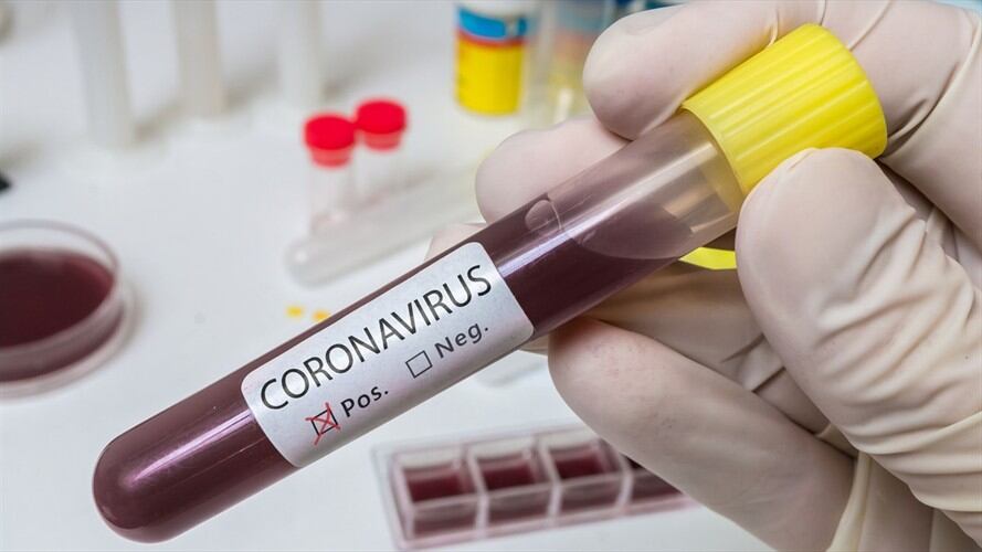 La Universidad de Oxford en Reino Unido anunció que se encuentra desarrollando una posible vacuna para el nuevo coronavirus. Foto: Getty Images