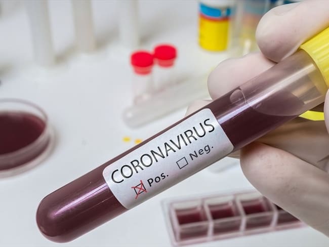 La Universidad de Oxford en Reino Unido anunció que se encuentra desarrollando una posible vacuna para el nuevo coronavirus. Foto: Getty Images