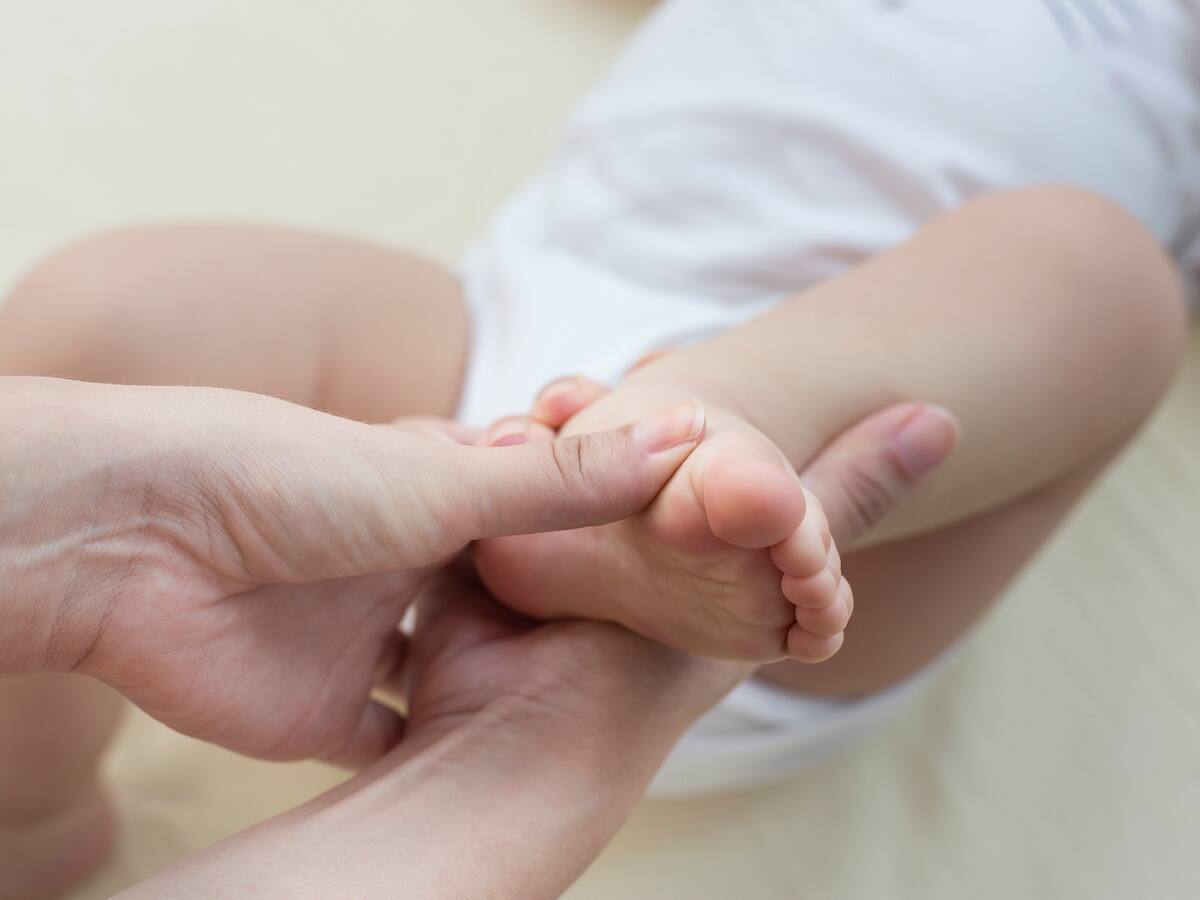 ¿Qué es el pie equinovaro y cuál es el tratamiento? Experto responde