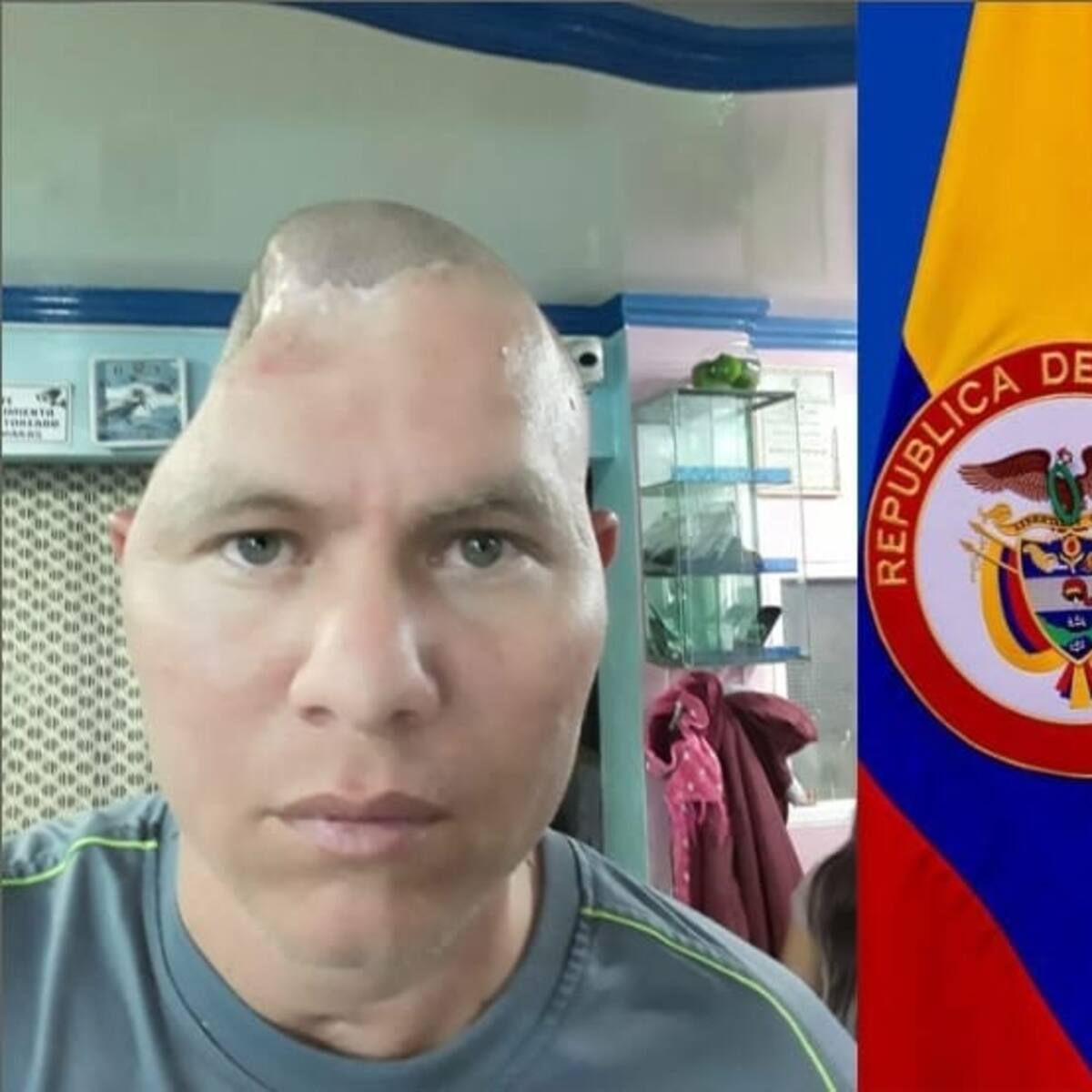 Sargento José Sánchez desafió la muerte: estuvo 2 meses en coma tras caer en campo minado