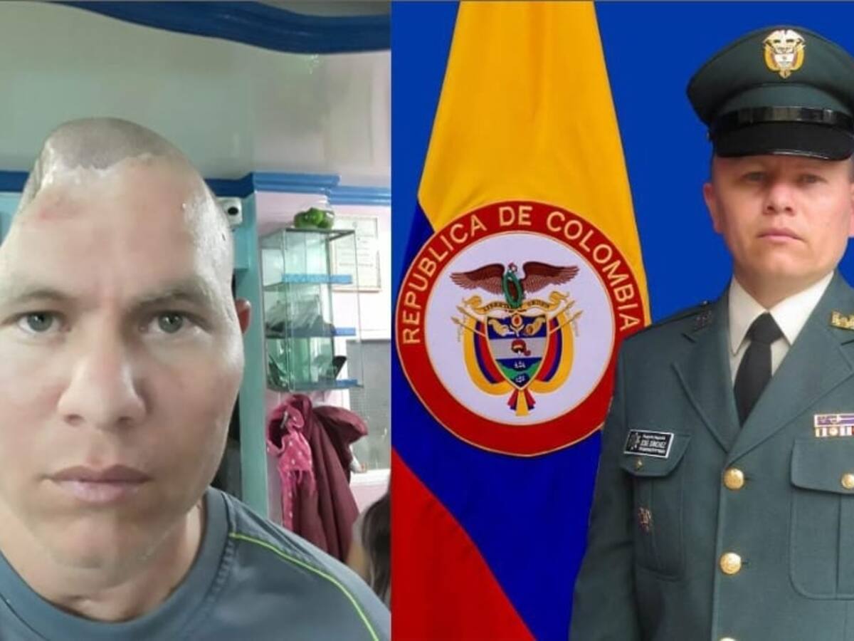 Sargento José Sánchez desafió la muerte: estuvo 2 meses en coma tras caer en campo minado