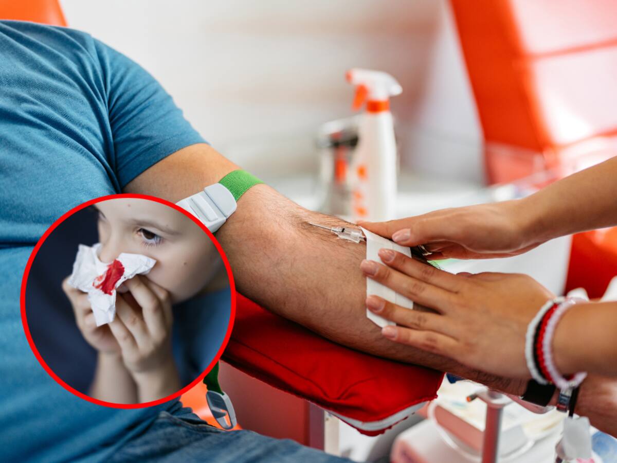 Cerca de 700 niños con hemofilia estarían en riesgo por falta de profilaxis, advierte hematoncólogo