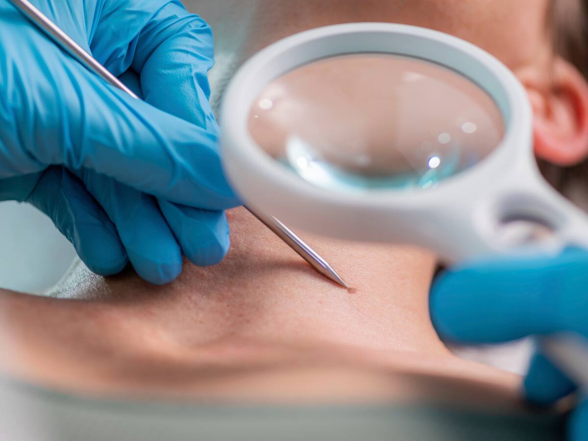 Soluciones W: joven recibirá tratamiento dermatológico tras varios intentos fallidos