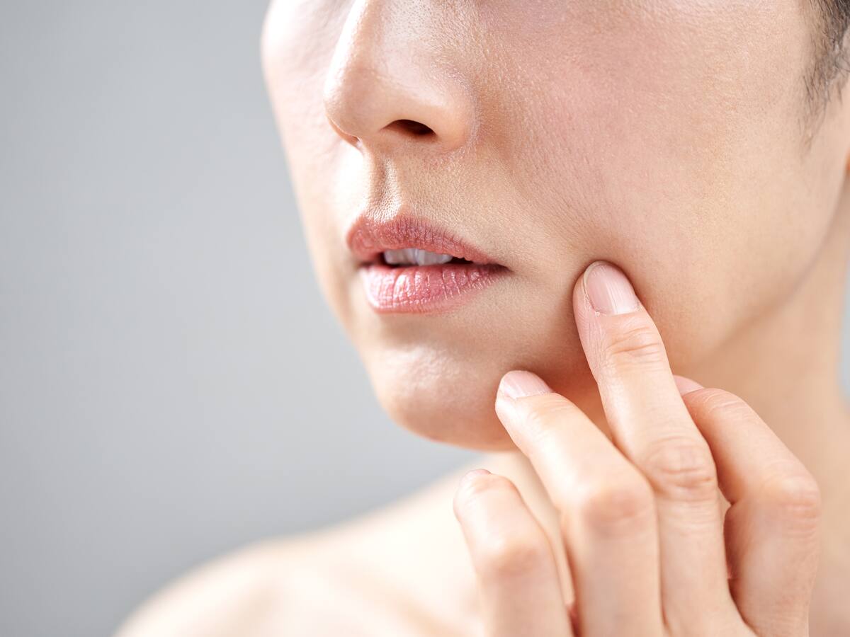 ¿Se pueden quitar las manchas de nacimiento? Dermatólogo respondió