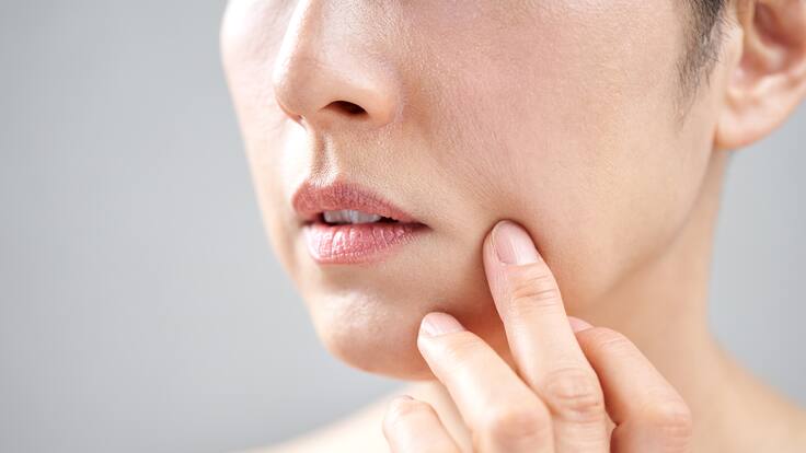 ¿Se pueden quitar las manchas de nacimiento? Dermatólogo respondió