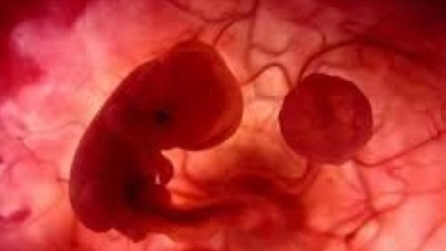 Padre pide que su expareja no se haga el aborto. . Foto: suministrada.