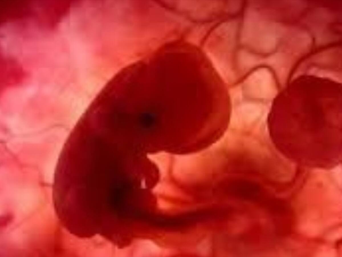 Hombre pide a su expareja que no aborte a su hijo