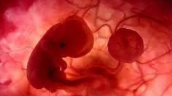 Padre pide que su expareja no se haga el aborto. . Foto: suministrada.