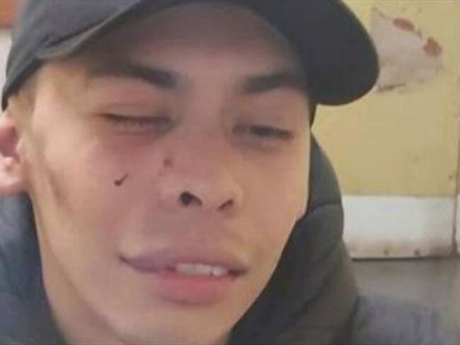 Colombiano narra cómo Ejército chileno lo agredió por una 'equivocación' durante protestas