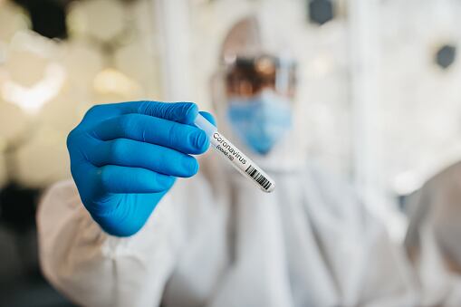 Referencia resultados COVID-19. Foto: Getty