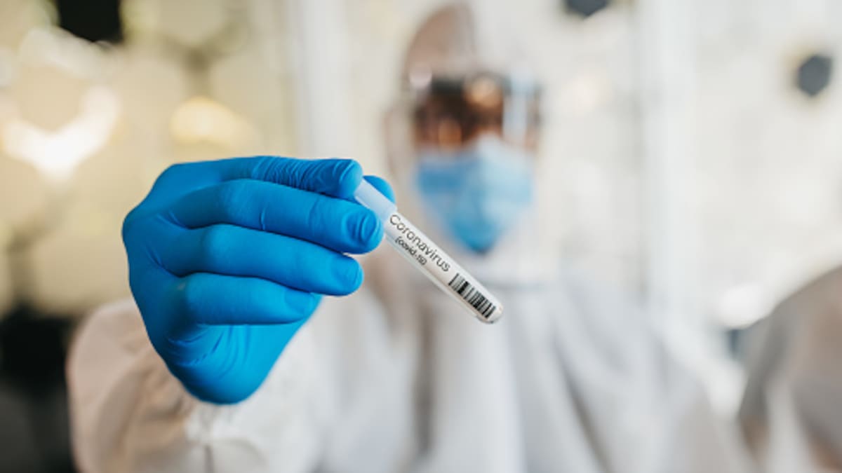 COVID-19 en Colombia: 1.088 nuevos contagios y 54 fallecimientos este domingo