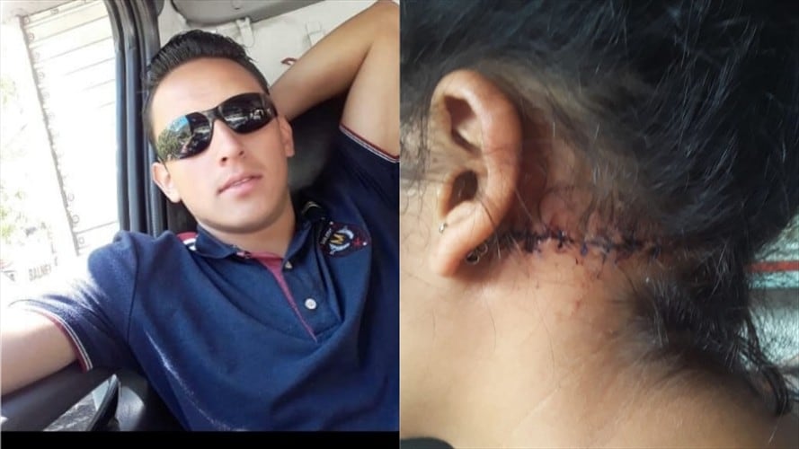 Joven de 21 años denuncia que fue brutalmente atacada por su novio. Foto: Archivo particular