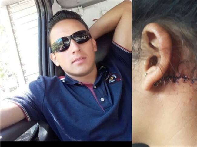 Joven de 21 años denuncia que fue brutalmente atacada por su novio. Foto: Archivo particular