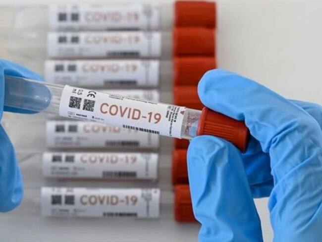 Desarrollarán estudio en Cúcuta para conocer expansión e inmunidad del COVID-19. Foto: Cortesía