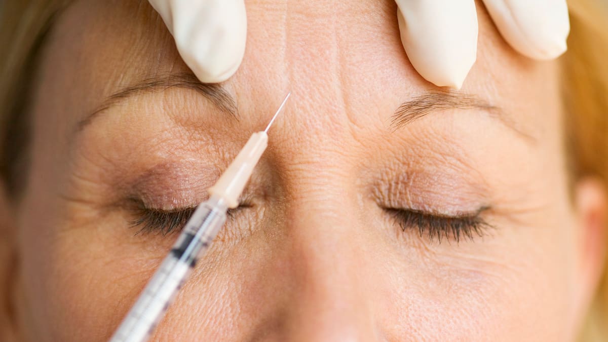¿Por qué se producen las deformidades por bótox? Médico cirujano explica