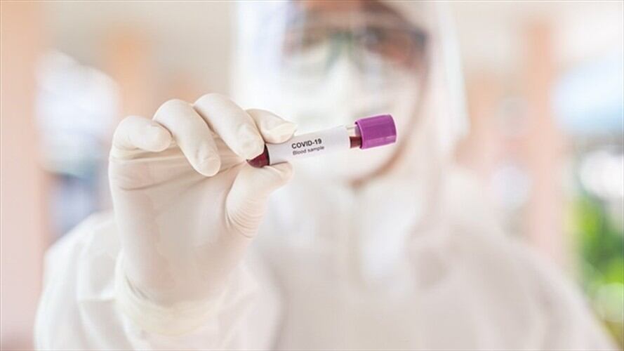 COVID-19, influenza A y B y otros virus respiratorios, así como tosferina y tuberculosis serán diagnosticadas, contenidas y monitoreadas gracias a estos laboratorios.. Foto: Getty Images