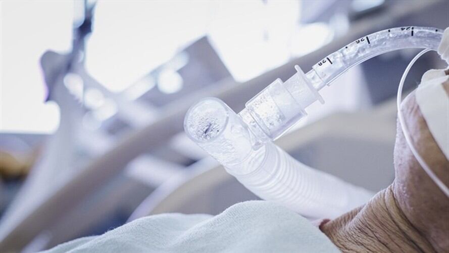 El duplicador está conformado por una serie de accesorios y tubos de plástico, un dispositivo divisor de circuito impreso en 3D de ventilación pulmonar múltiple para pacientes con COVID-19. . Foto: Getty Images