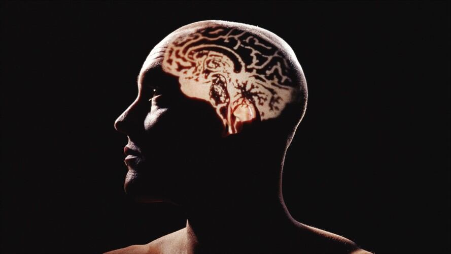 Por qué la ciencia necesita con urgencia tu cerebro. Foto: Getty Images