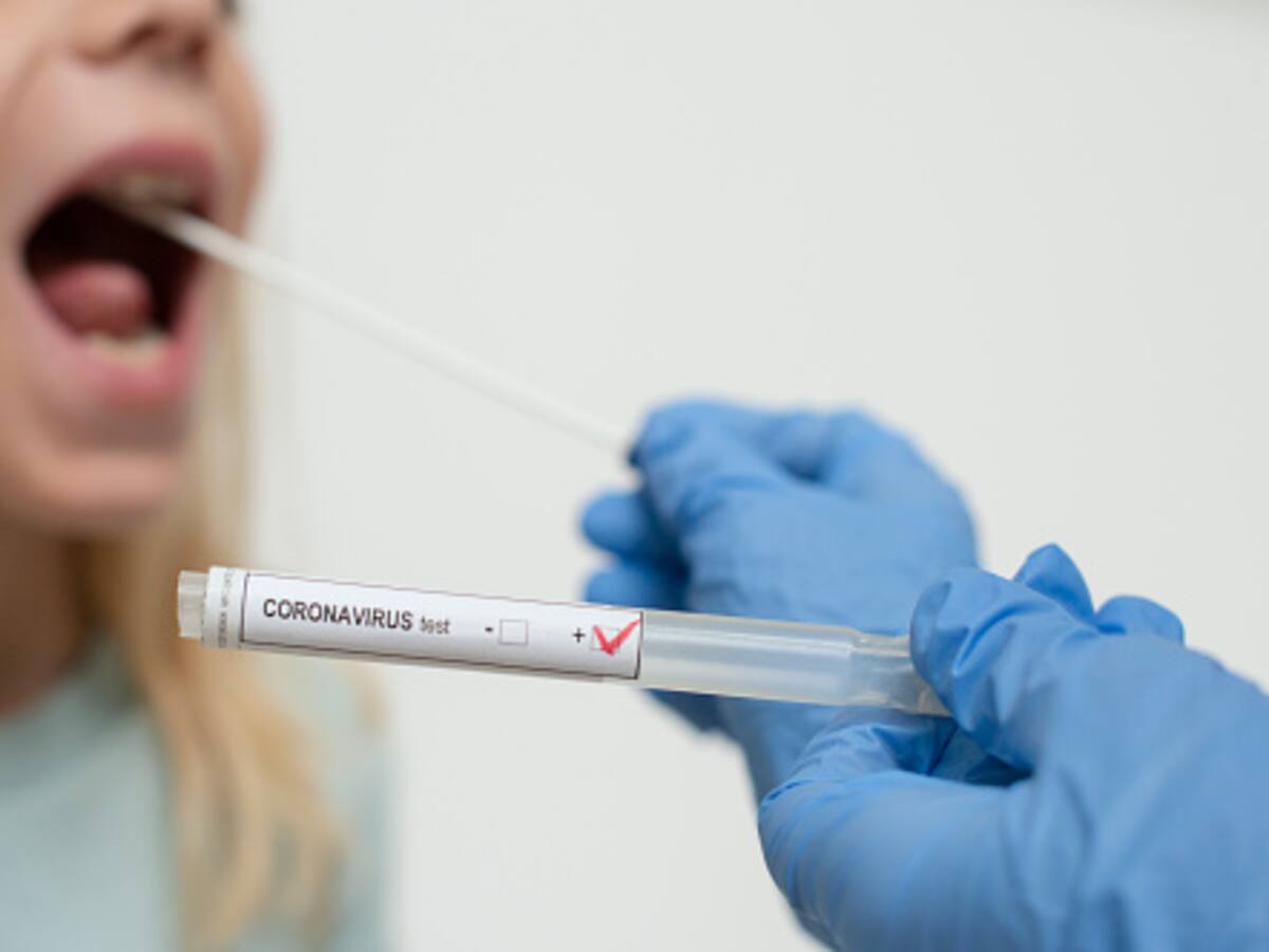 COVID-19 en Colombia: leve descenso en el número de nuevos contagios este miércoles