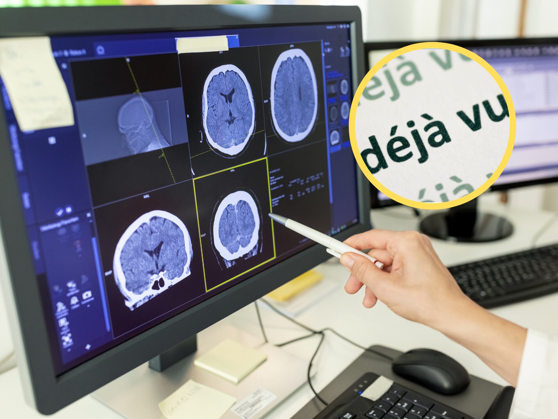 Médico revisando una tomografía cerebral, encima la palabra 'déjà vu' (GettyImages)