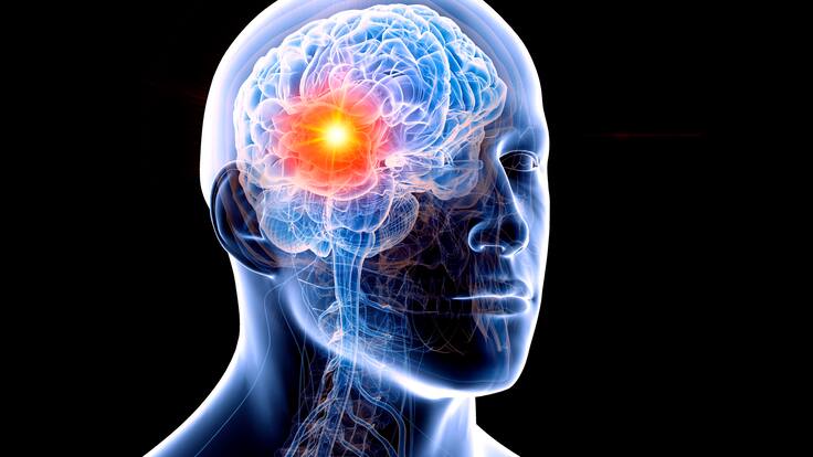 Probabilidad de que tumor desapareciera era menor a 10%: paciente sobreviviente al cáncer de cerebro