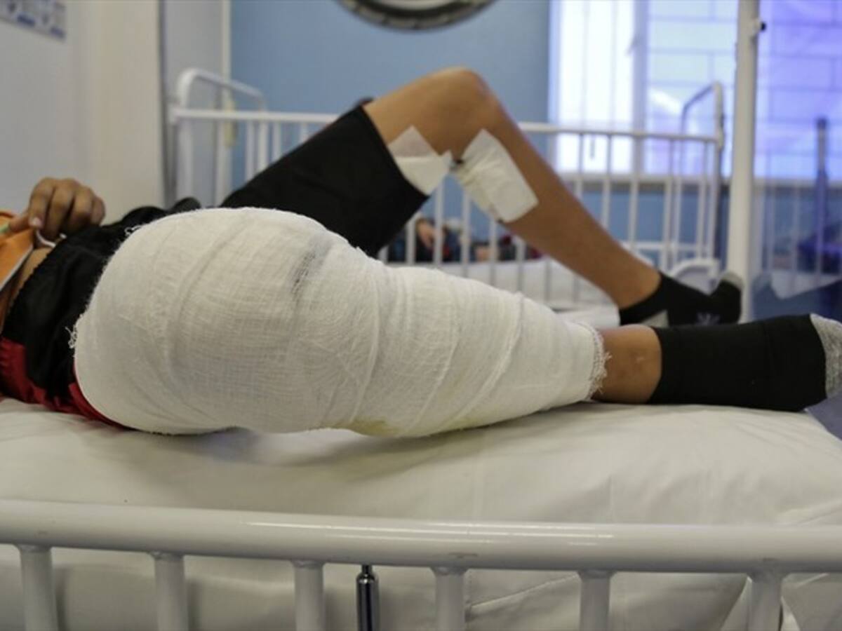 En Córdoba reportan 10 casos de quemados con pólvora